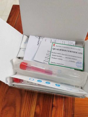 ウイルスのインフルエンザ テスト血の標本の管